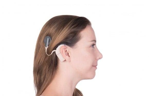 American Academy of Audiology Endorses New Cochlear Implant Candidacy Guidelines