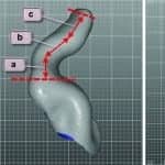 An Innovative Otoblock that Enables Deeper Impression Taking