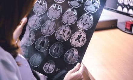 Antidepressant and Incontinence Medications Linked to Increased Risk of Dementia
