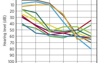 Designing Hearing Aid Technology to Support Benefits in Demanding Situations, Part 2