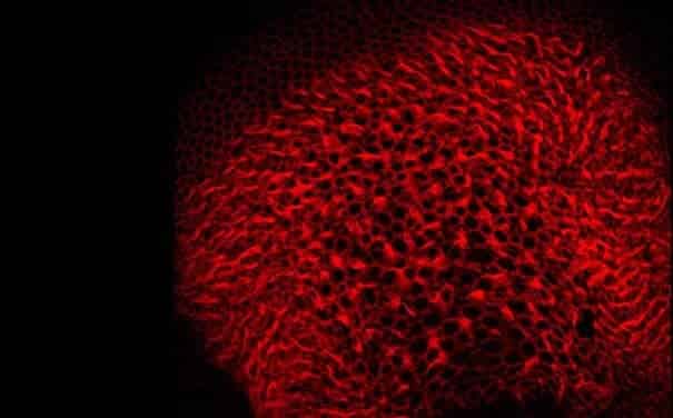 Partial Hearing and Balance Restored in Deaf Mice Using New Gene-delivery Therapy