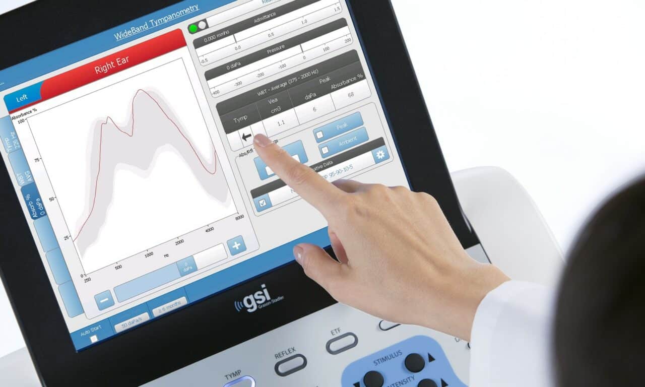 Implementation and Interpretation of WideBand Tympanometry