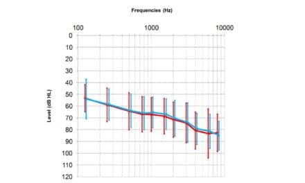Comparison of Different Directional Microphone Technologies for Moderate-to-Severe Hearing Loss