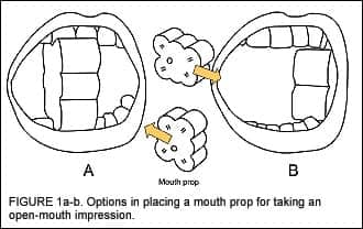 Earmolds and Hearing Aid Shells: A Tutorial Part 2: Impression-Taking Techniques that Result in Fewer Remakes
