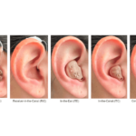 Survey Details OTC Self-Fitting Hearing Aid Users’ Experiences, Perceptions