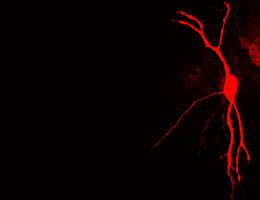Research: Nerve Cells Adapt to Acoustic Signals